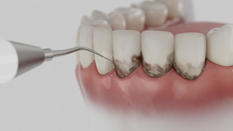 Reliable Dental Implants contractor in Conroe, TX by Smile Center Dentistry